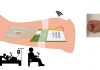 Sweat based non-invasive point of health diagnosis technology Sweat based non-invasive point of health diagnosis technology