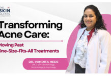 Redefining Acne Treatment: Moving Beyond One-Size-Fits-All Solutions